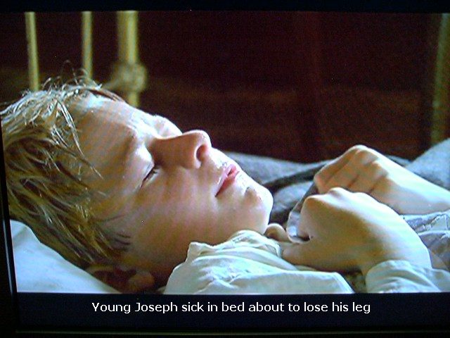 Joseph Smith leg surgery.